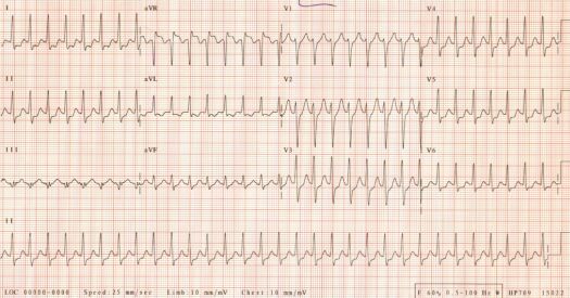 1st ECG of October